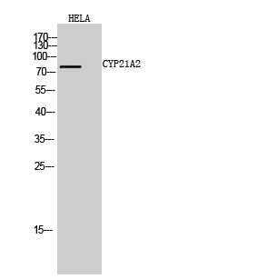 CYP21A2 Rabbit Polyclonal Antibody