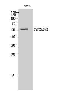 CYP2A6V2 Rabbit Polyclonal Antibody
