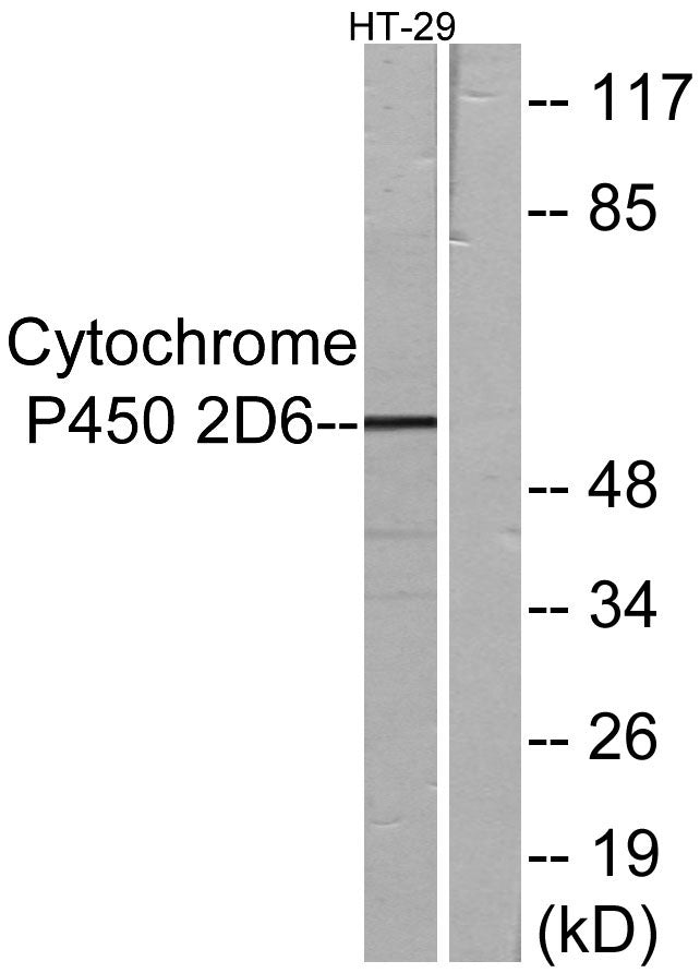 CYP2D6 Rabbit Polyclonal Antibody