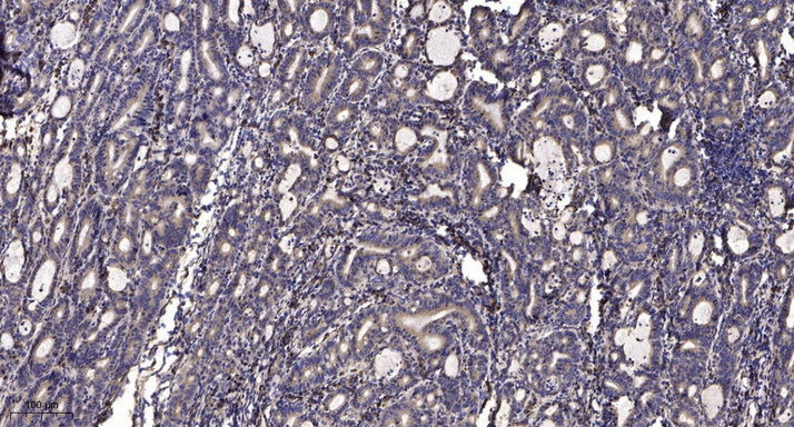 CYP4V2 Rabbit Polyclonal Antibody