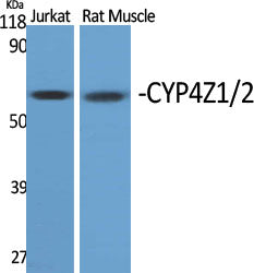 CYP4Z1/2 Rabbit Polyclonal Antibody