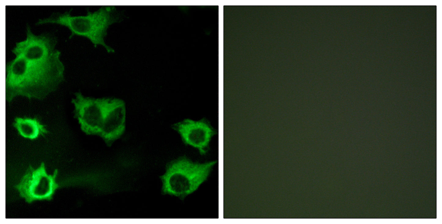 CysLTR1 Rabbit Polyclonal Antibody