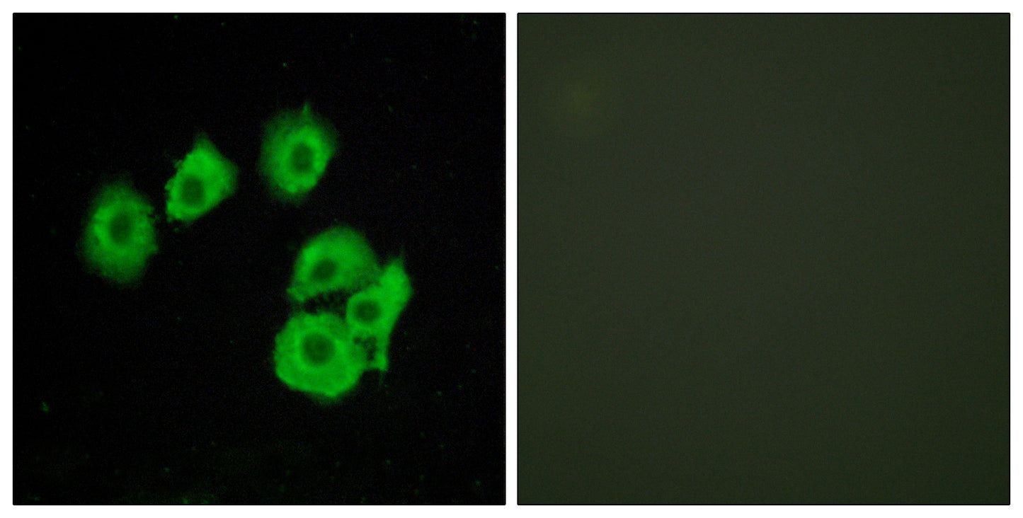 CysLTR1 Rabbit Polyclonal Antibody