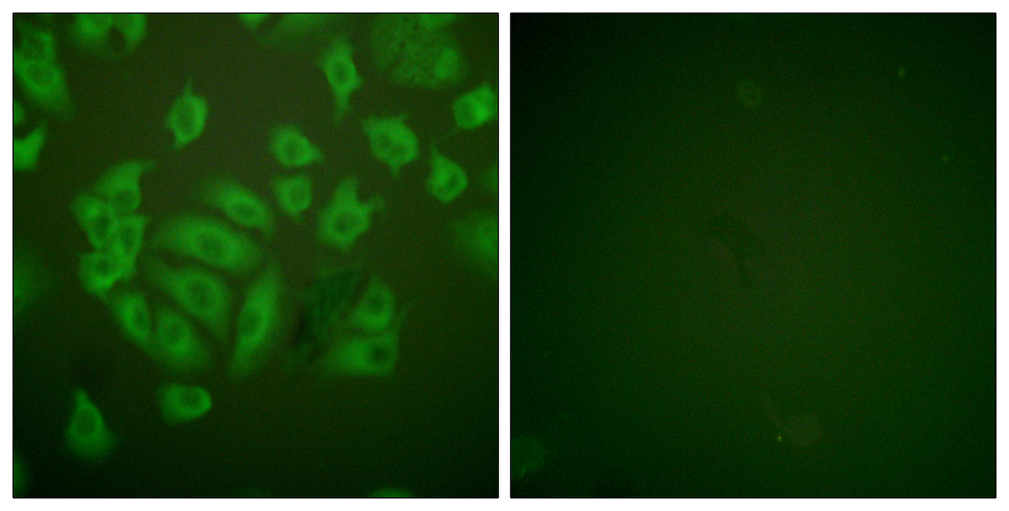 Cystatin A Rabbit Polyclonal Antibody
