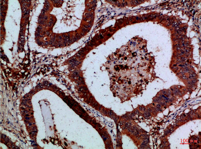 Cystatin B Rabbit Polyclonal Antibody
