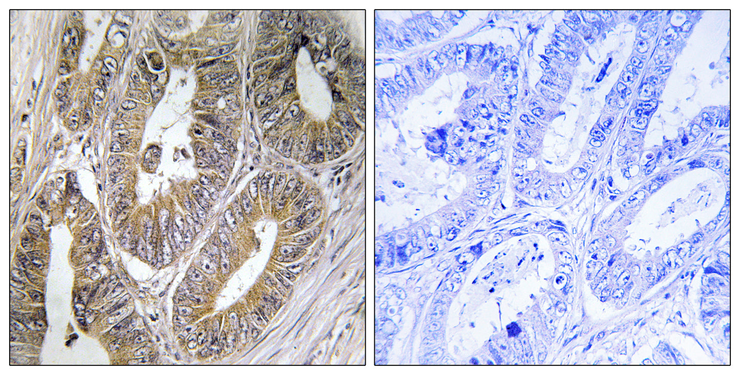 Cystatin SA Rabbit Polyclonal Antibody