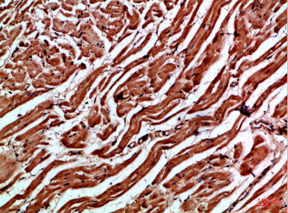 Cytoglobin Rabbit Polyclonal Antibody