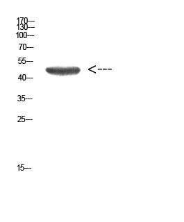 Cytokeratin 14/17 Rabbit Polyclonal Antibody