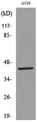 Cytokeratin 19 Rabbit Polyclonal Antibody
