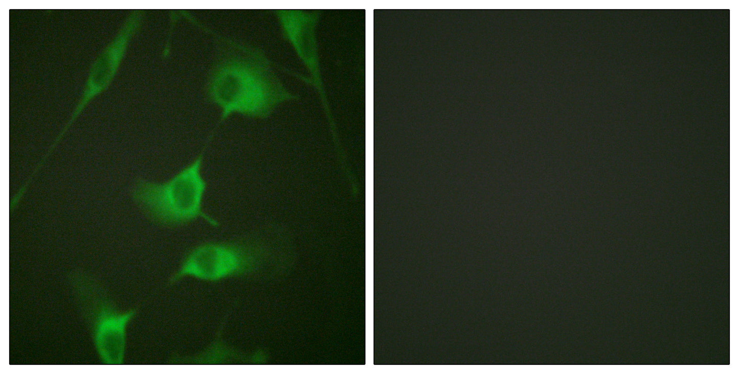Cytokeratin 8 Rabbit Polyclonal Antibody