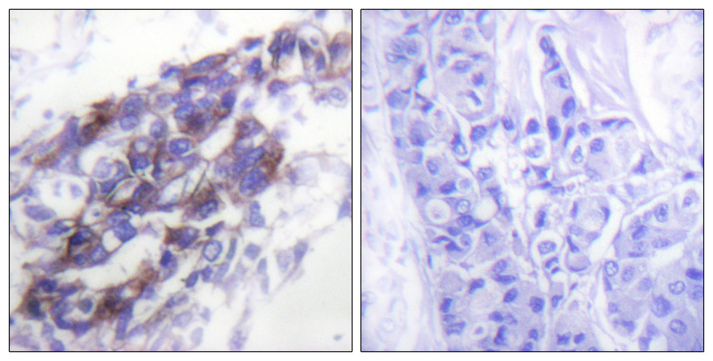 Cytokeratin 8 Rabbit Polyclonal Antibody