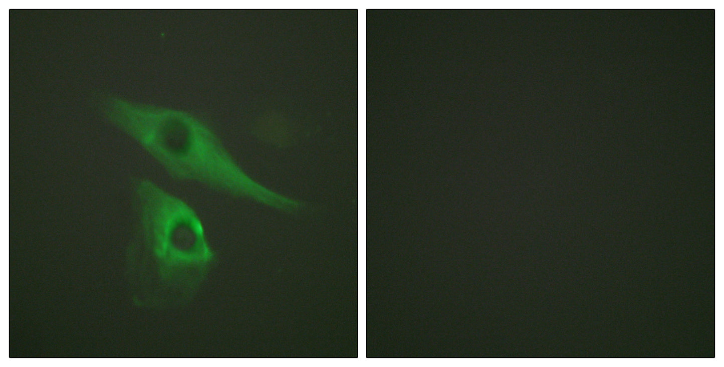 Cytokeratin 8 Rabbit Polyclonal Antibody