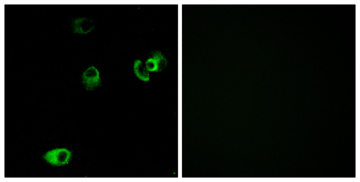 D4DR Rabbit Polyclonal Antibody