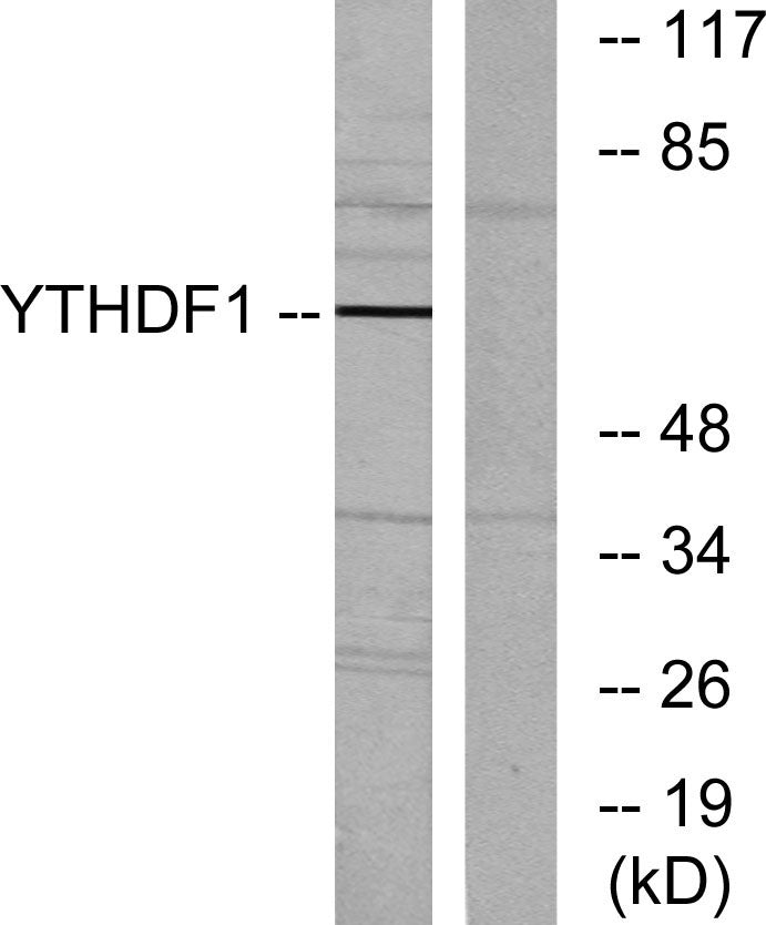 DACA-1 Rabbit Polyclonal Antibody