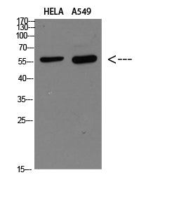 DCT Rabbit Polyclonal Antibody