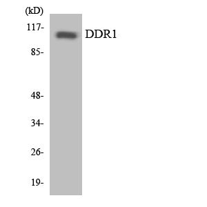 DDR1 Rabbit Polyclonal Antibody
