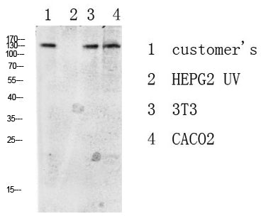 DDR1 Rabbit Polyclonal Antibody