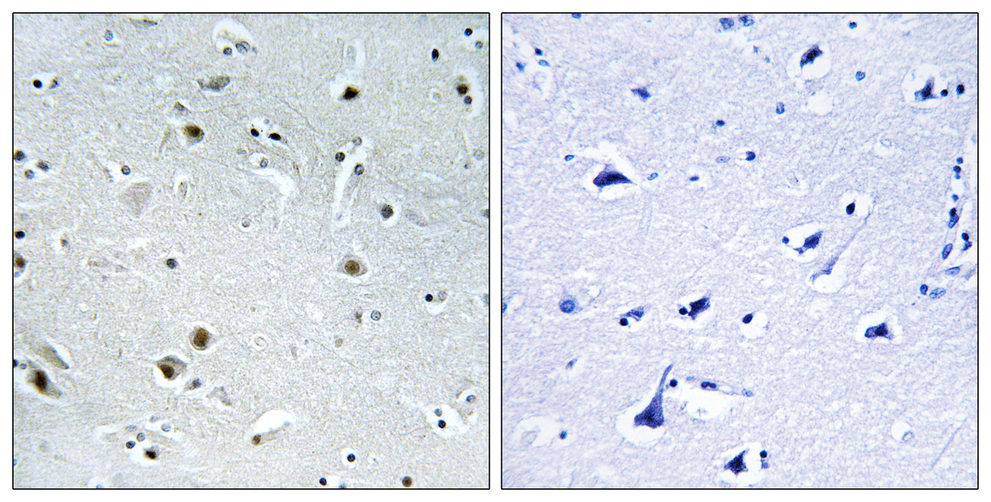 DDX24 Rabbit Polyclonal Antibody