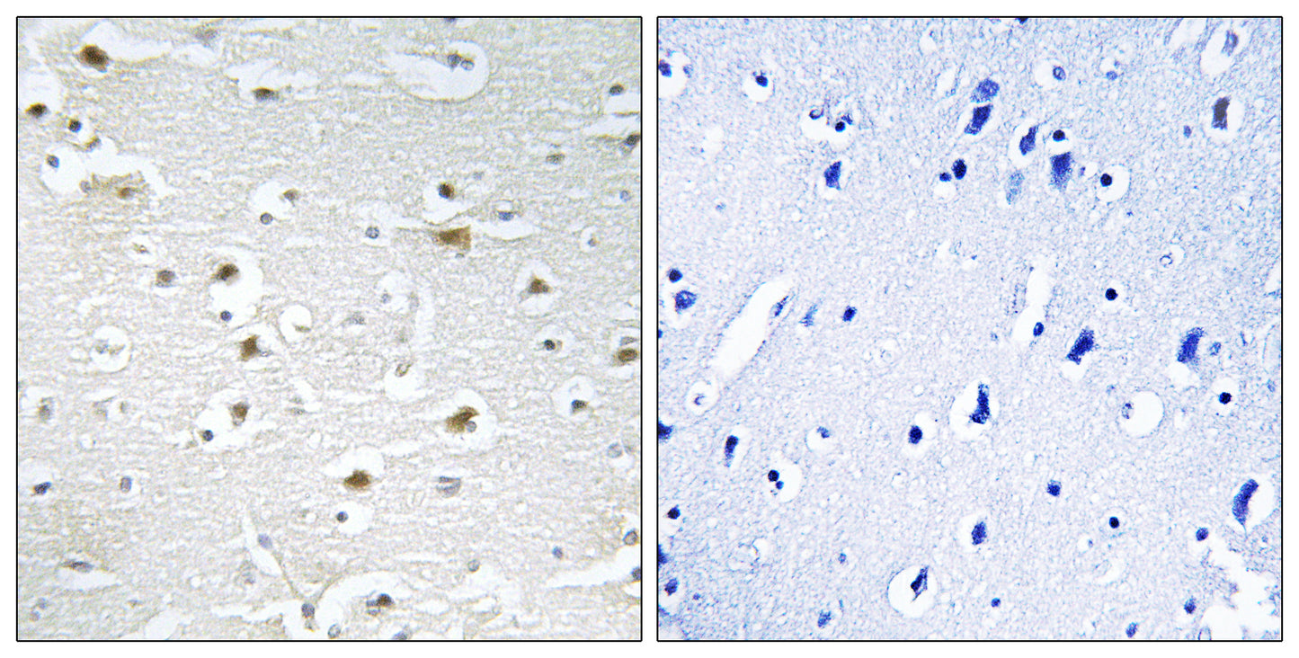 DDX3Y Rabbit Polyclonal Antibody