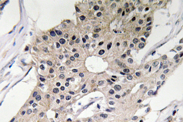 Defensin α1 Rabbit Polyclonal Antibody