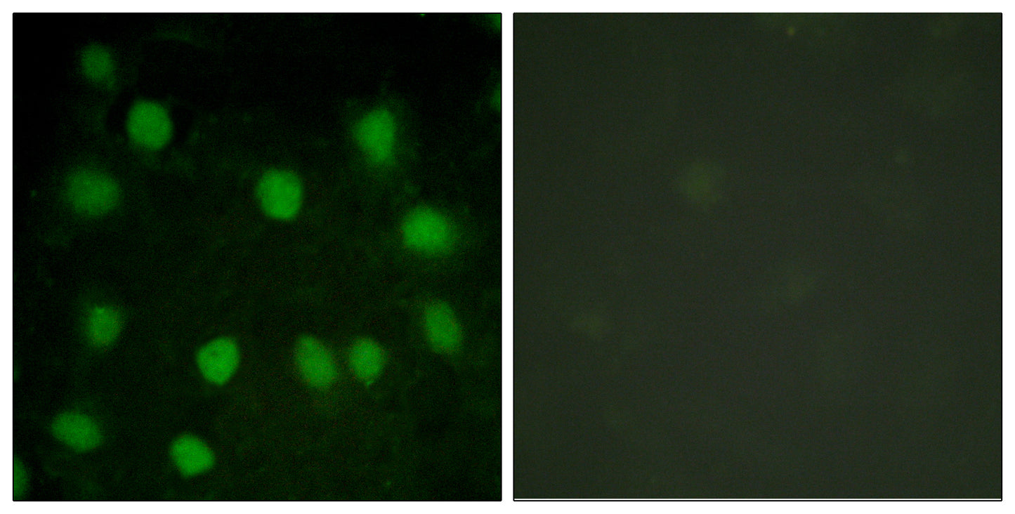 Dematin Rabbit Polyclonal Antibody