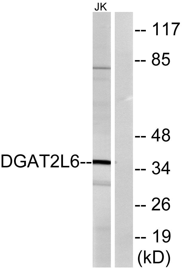 DGAT2L6 Rabbit Polyclonal Antibody