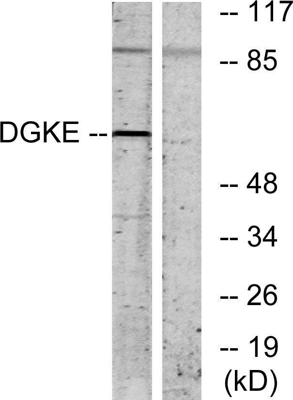 DGK-ε Rabbit Polyclonal Antibody