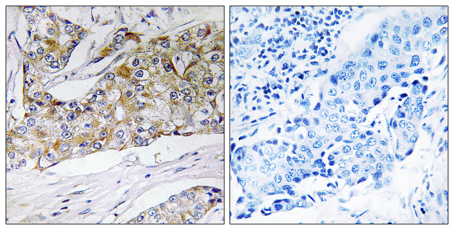 DHRS11 Rabbit Polyclonal Antibody