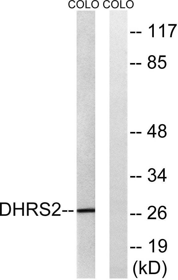 DHRS2 Rabbit Polyclonal Antibody