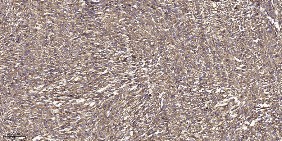 DIAP2 Rabbit Polyclonal Antibody