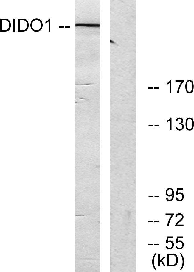 Dio-1 Rabbit Polyclonal Antibody