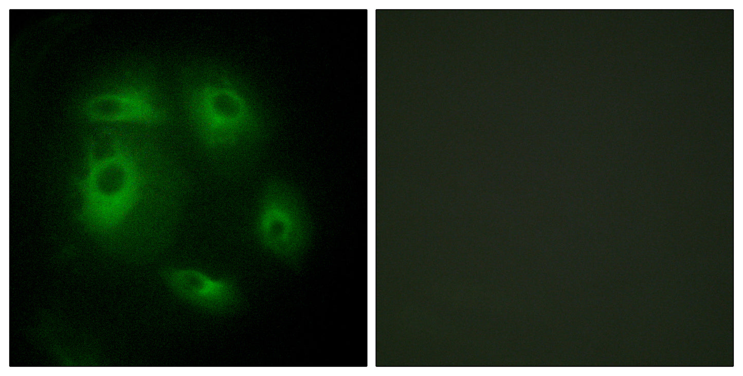 DLEC1 Rabbit Polyclonal Antibody