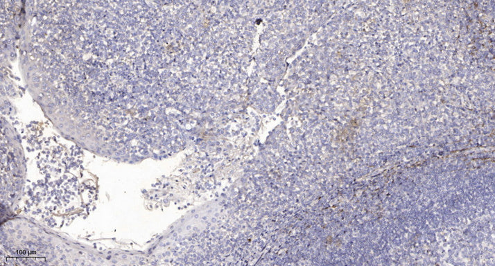 DMBT1 Rabbit Polyclonal Antibody