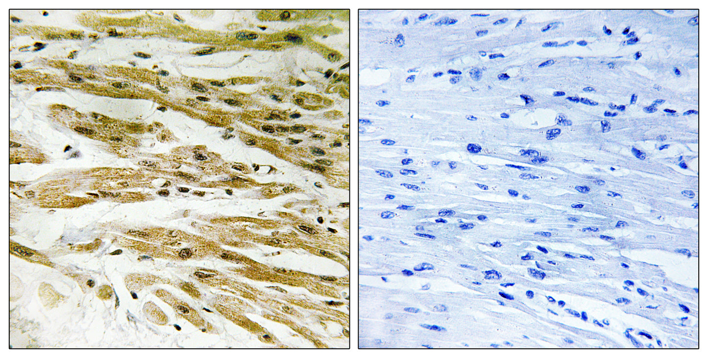 Dmc1 Rabbit Polyclonal Antibody