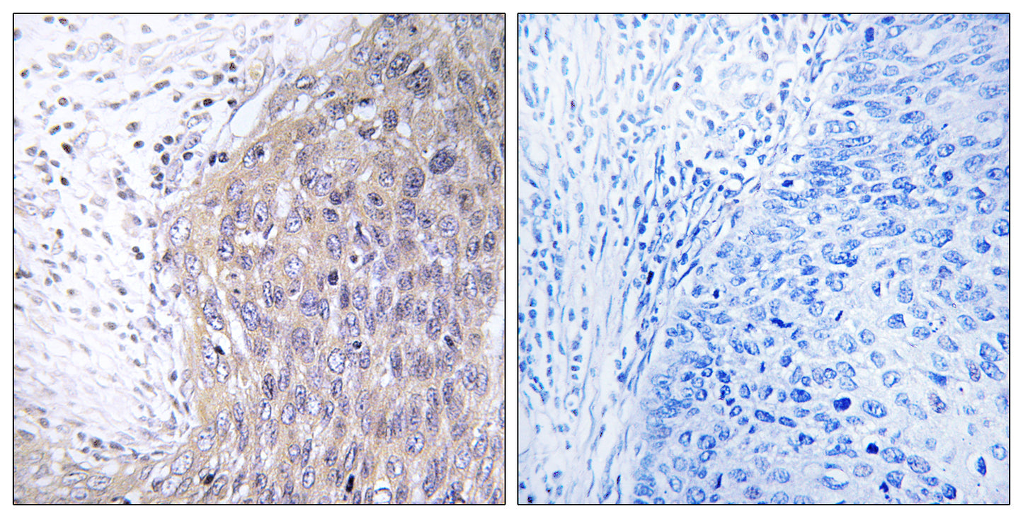 DNA pol γ2 Rabbit Polyclonal Antibody