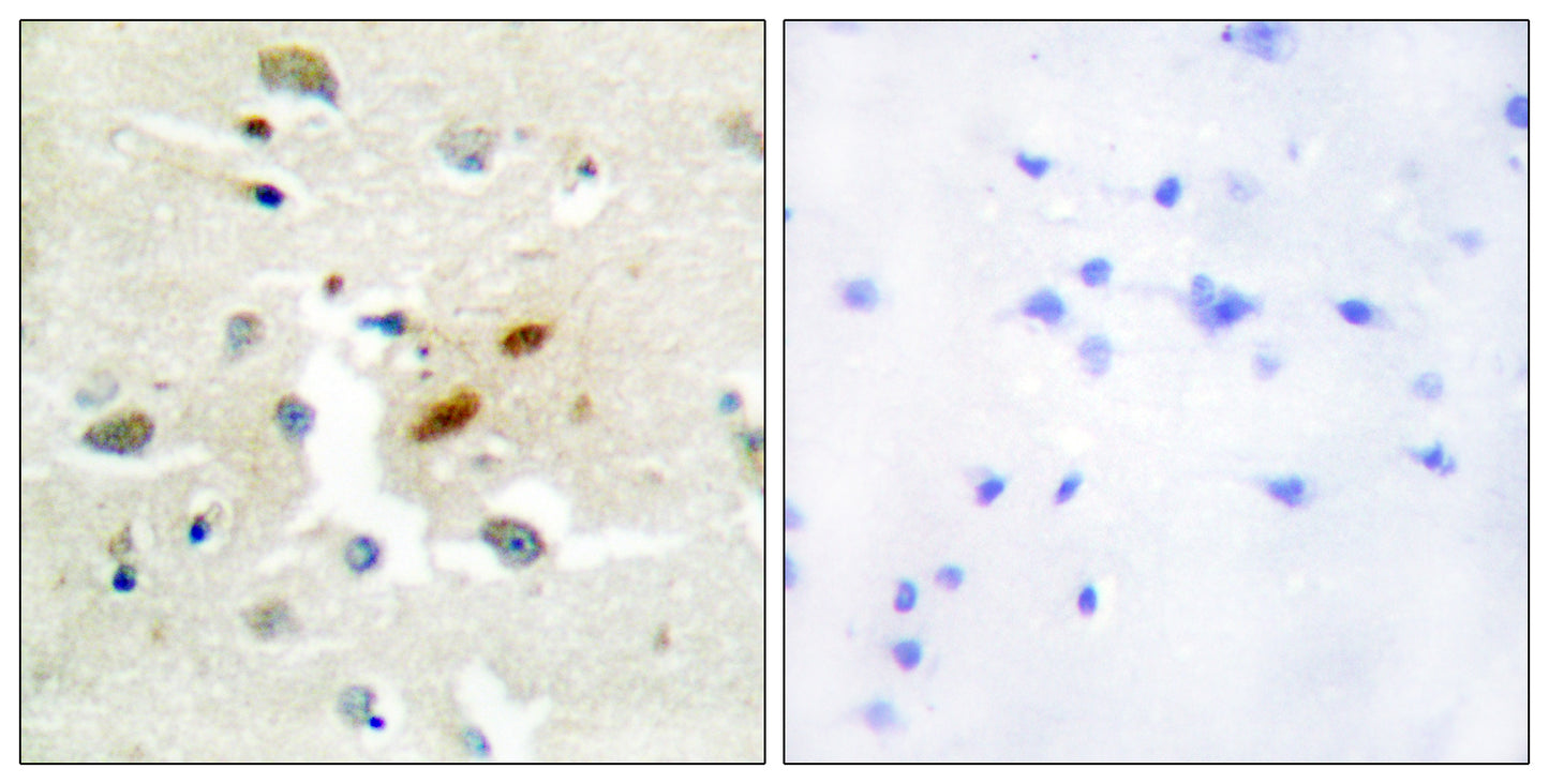 DNA pol ζ Rabbit Polyclonal Antibody