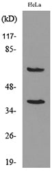 DNAM-1 Rabbit Polyclonal Antibody