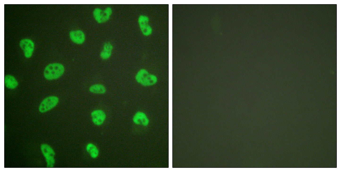 DNA-PKCS Rabbit Polyclonal Antibody