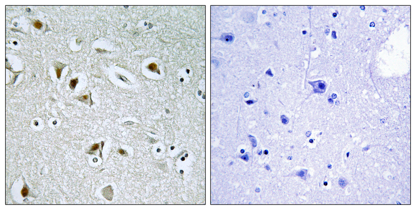 DOC-1R Rabbit Polyclonal Antibody