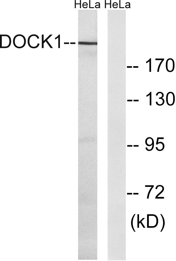 DOCK 180 Rabbit Polyclonal Antibody