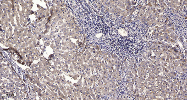 DOCK 2 Rabbit Polyclonal Antibody