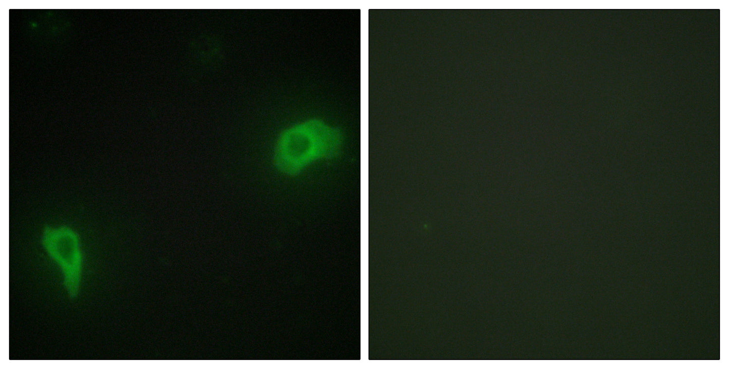 Dok-7 Rabbit Polyclonal Antibody