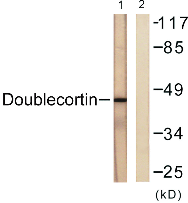 Doublecortin Rabbit Polyclonal Antibody