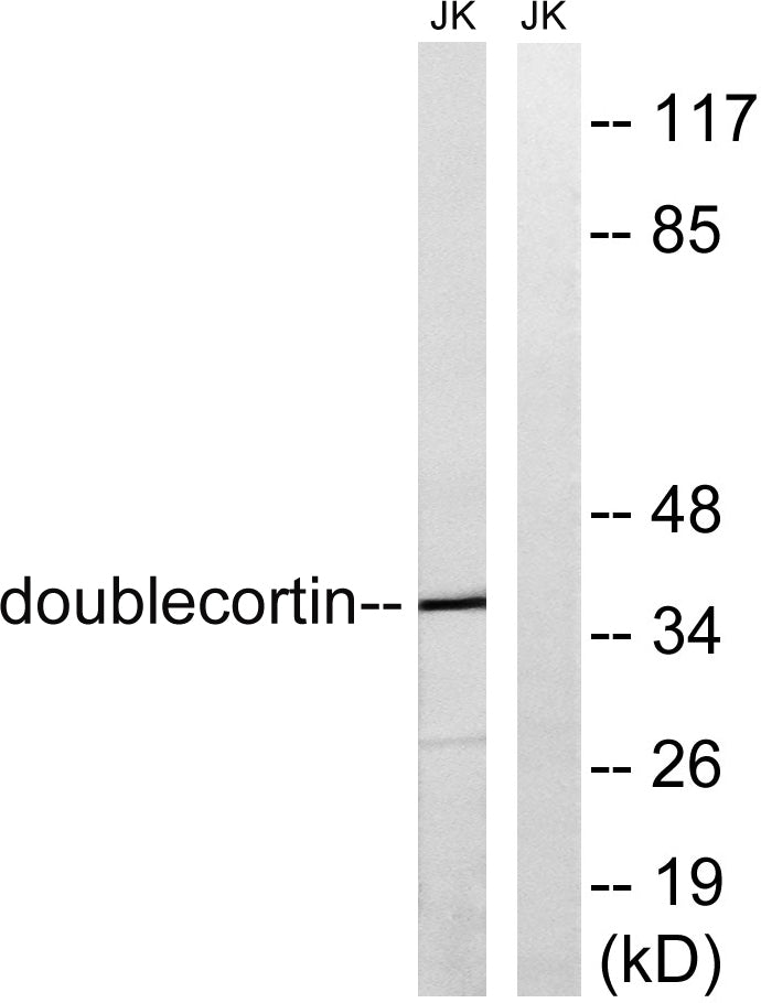 Doublecortin Rabbit Polyclonal Antibody