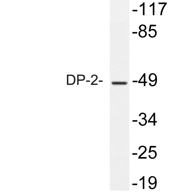 DP-2 Rabbit Polyclonal Antibody