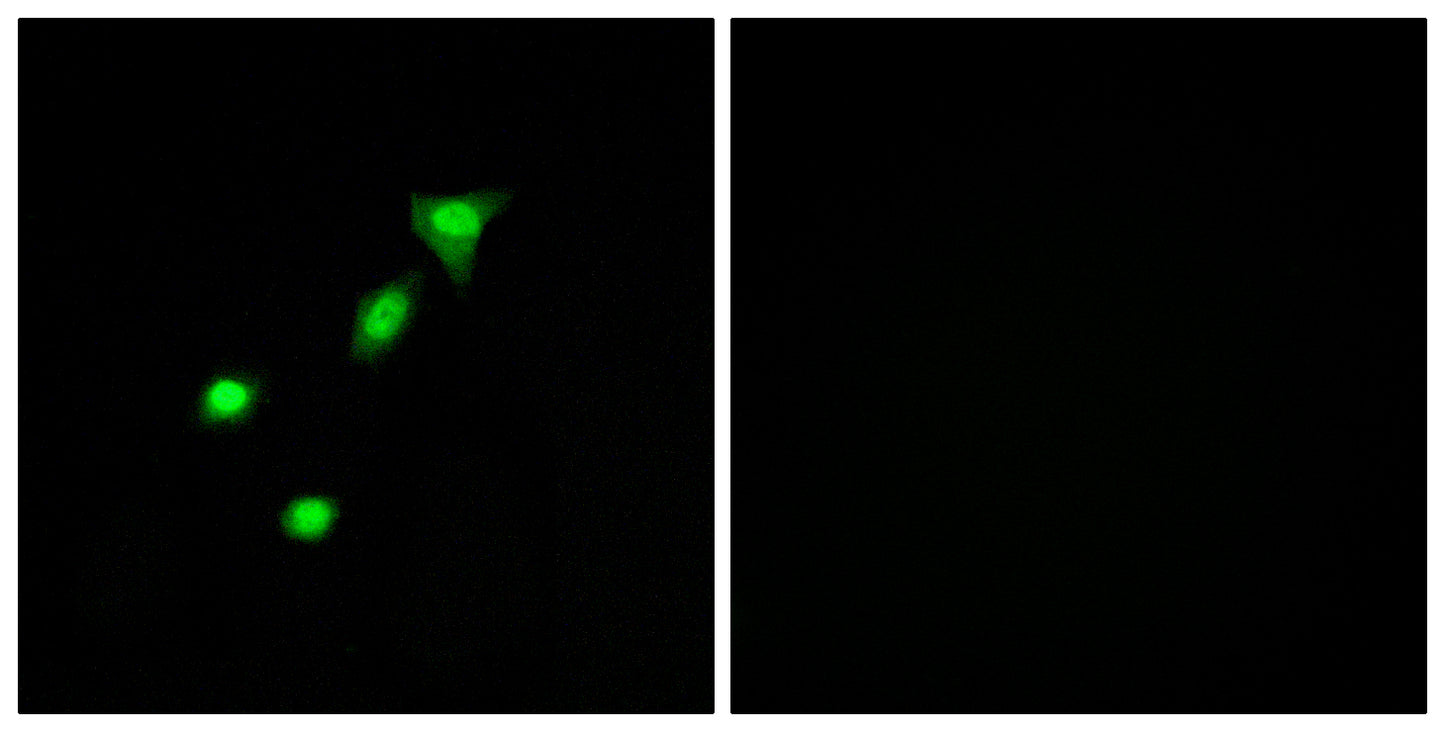 DPF2 Rabbit Polyclonal Antibody
