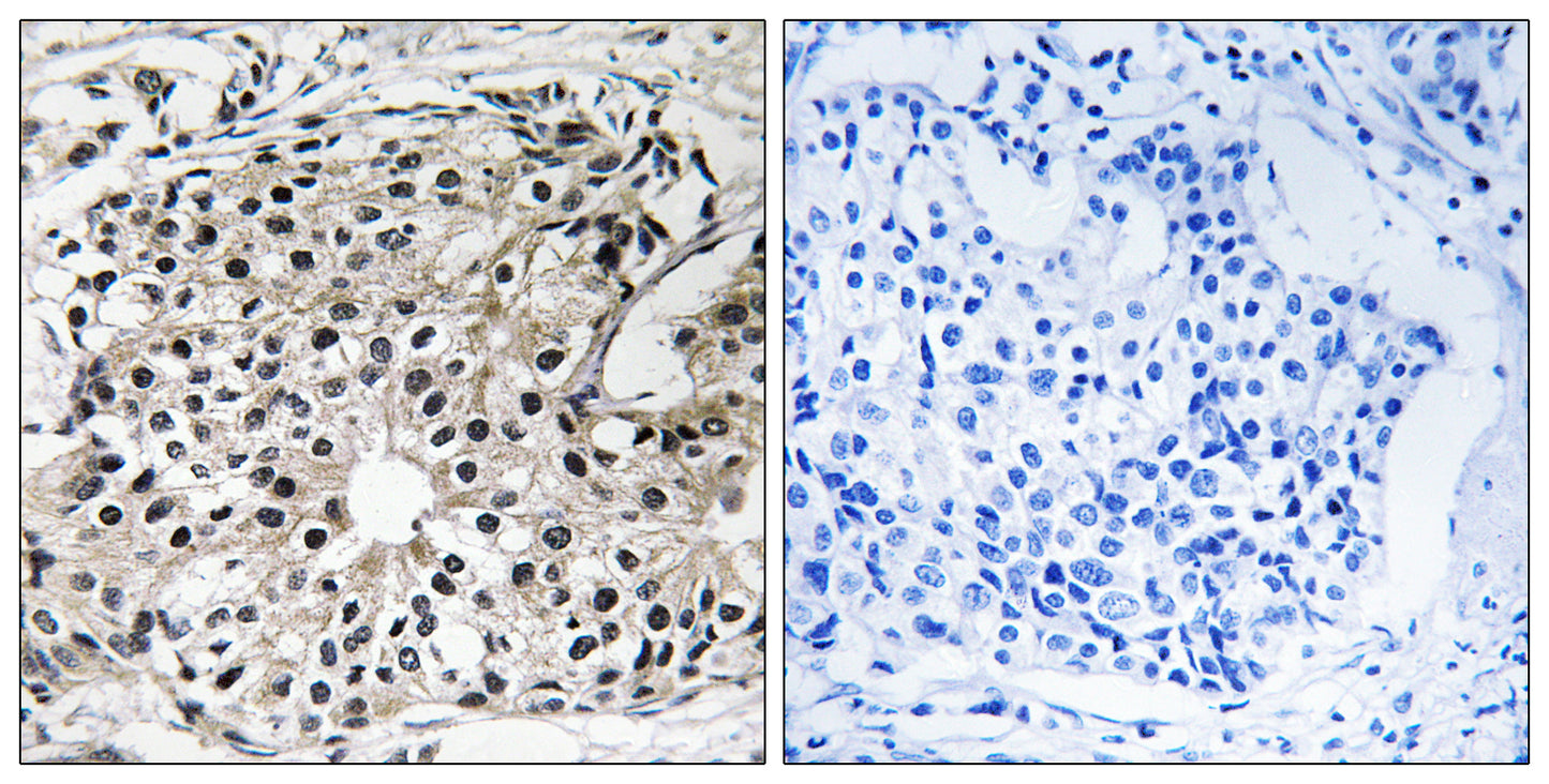 DRS-1 Rabbit Polyclonal Antibody