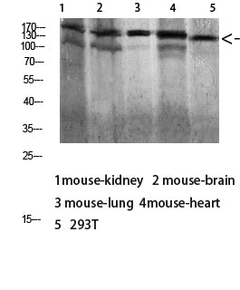 Dsg1 Rabbit Polyclonal Antibody