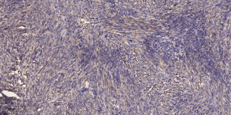 DYHC1 Rabbit Polyclonal Antibody