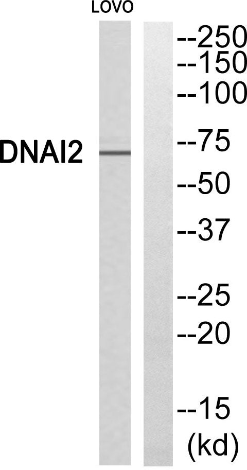 Dynein IC2 Rabbit Polyclonal Antibody